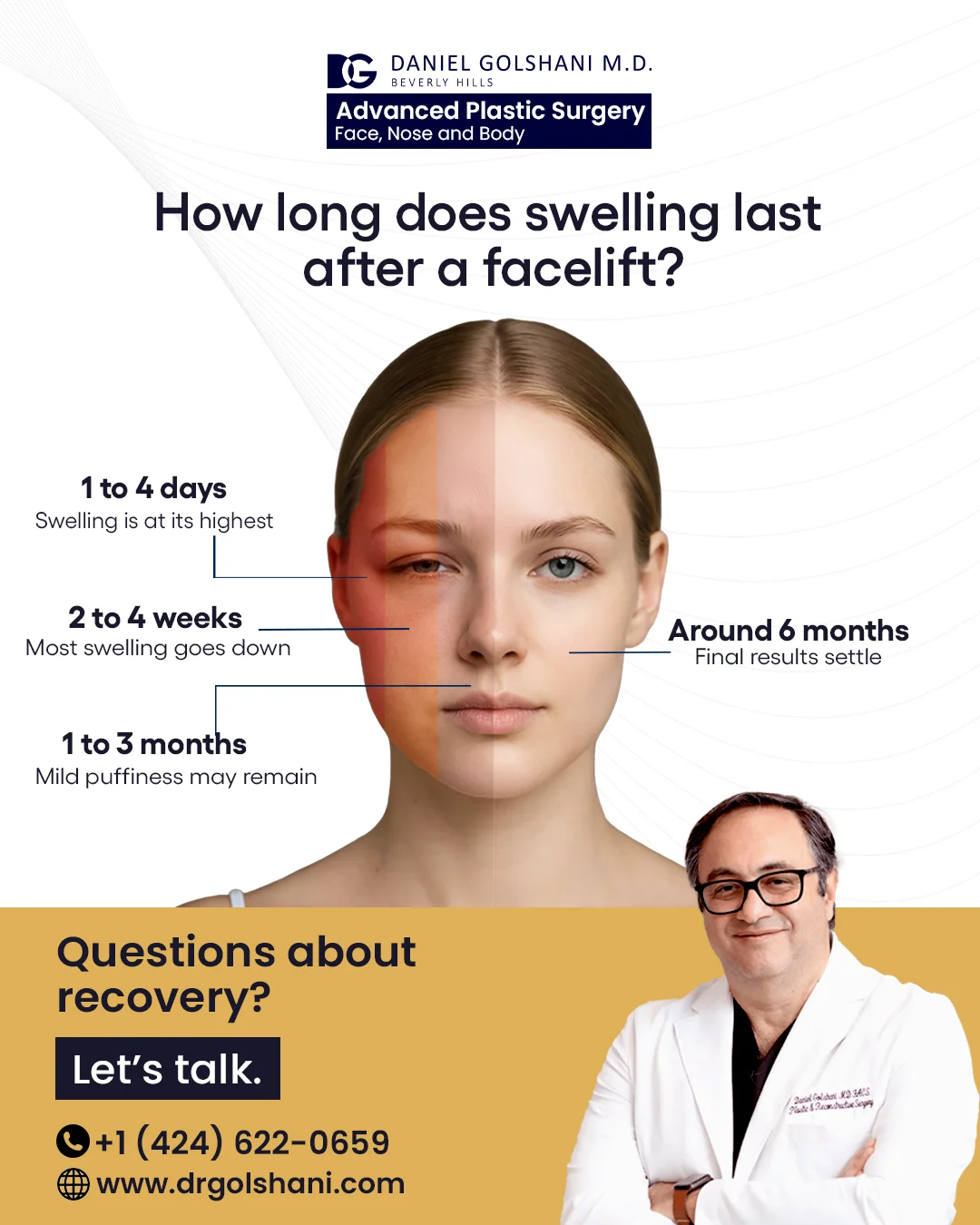 Facelift Swelling Timeline Post